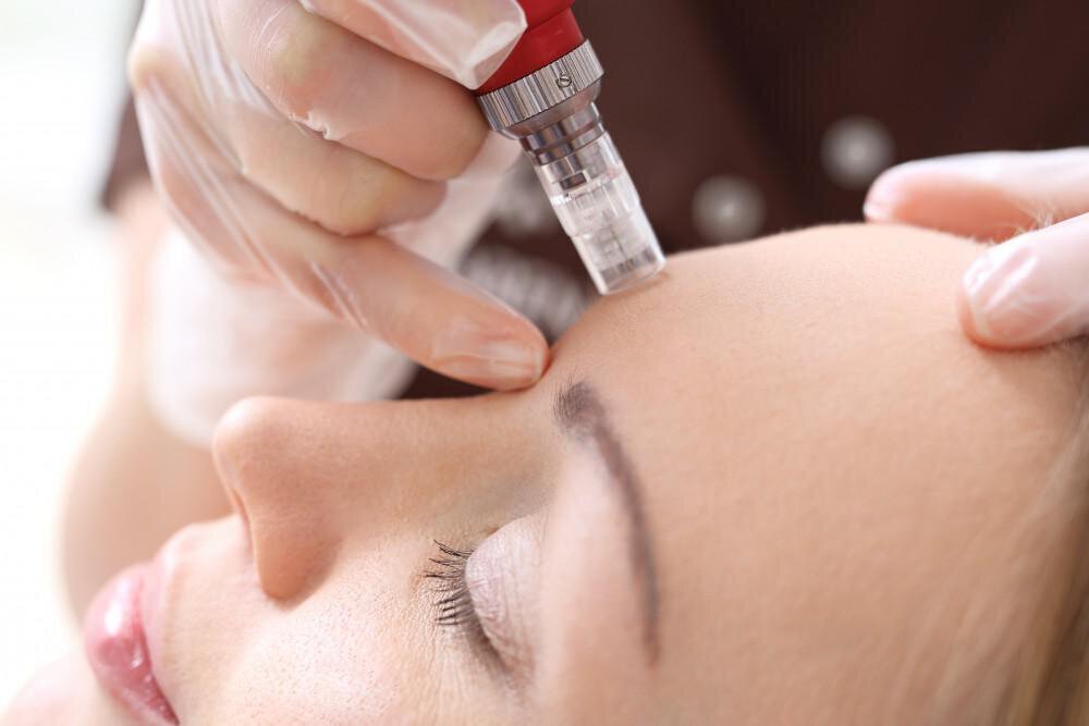 Londonderry medspa model with blonde hair
