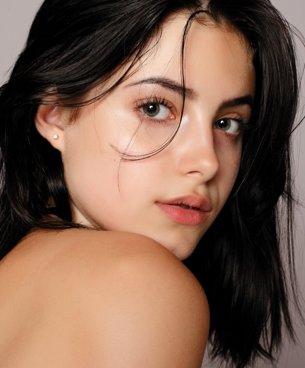 Londonderry dermal fillers model with black hair