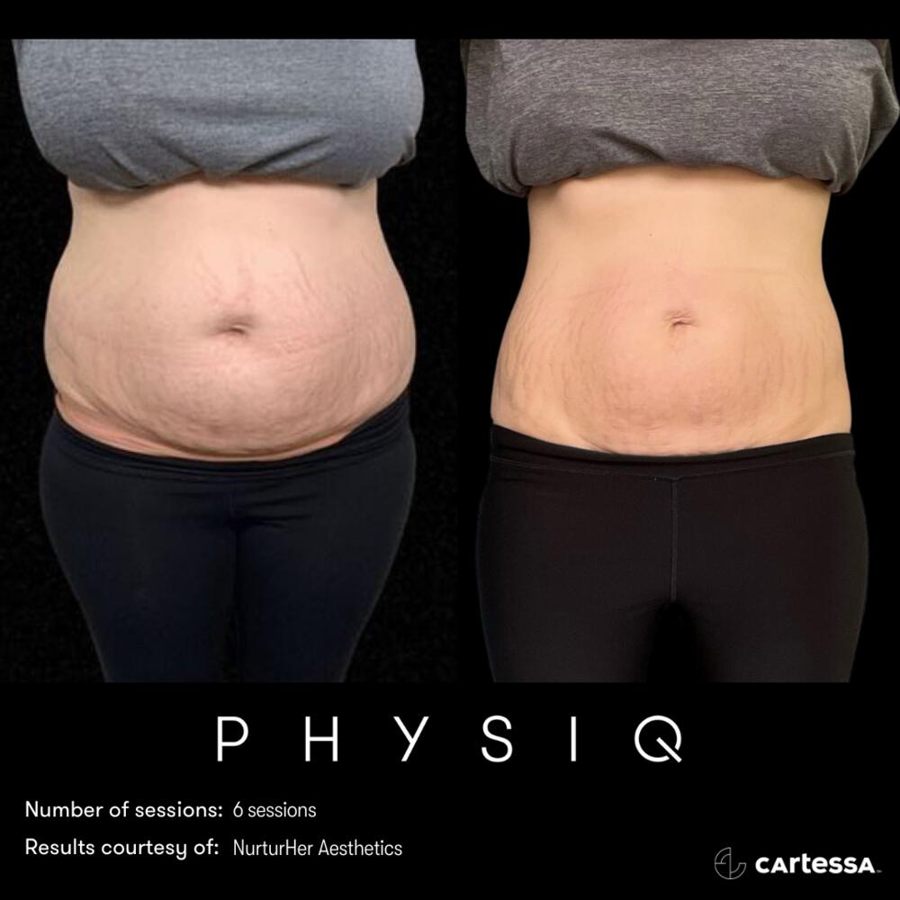 Physiq Before & After Image